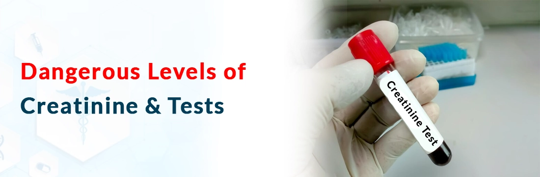 Dangerous Levels of Creatinine & Tests
